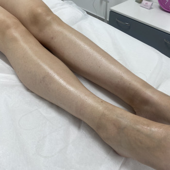 Депіляція
                    Майстер депіляції Олена Рівне