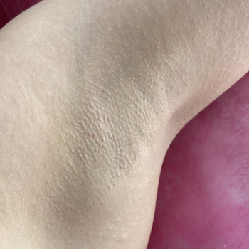 Депіляція
                    Майстер депіляції Олена Рівне