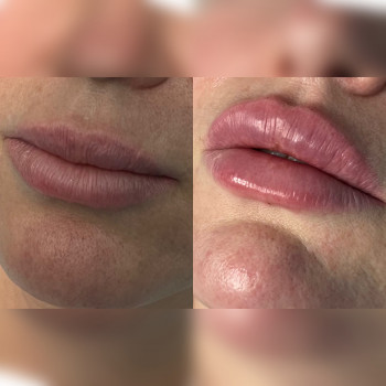 Виктория Кириловец, Борисполь Фото - 5