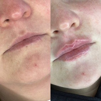 Виктория Кириловец, Борисполь Фото - 10