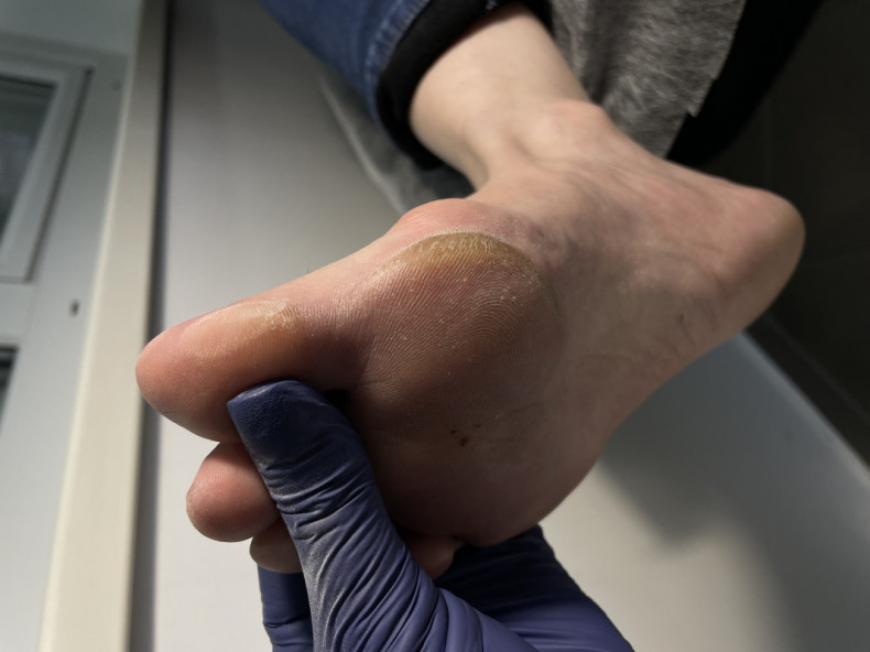 Стопа до чистки, фото - Майстер манікюру Екатерина Шутова