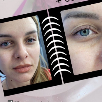 Алевтина Яковенко, Запорожье Фото - 20