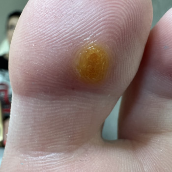 Після обробки.