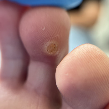 Проміжний результат відновлення