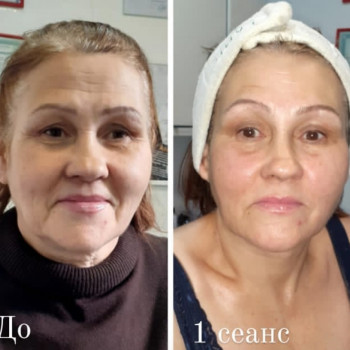 Sculptor lift massage