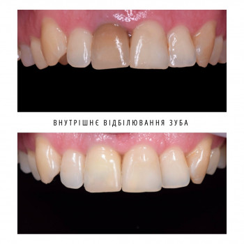 Роман Векленко, Київ Фото - 2