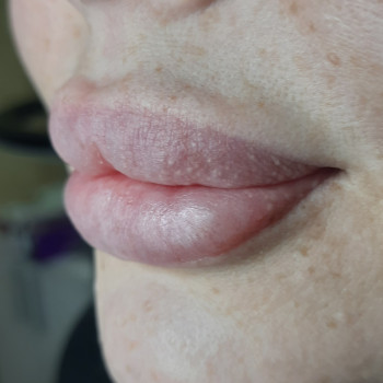 Людмила Дедерчук, Черноморск Фото - 7