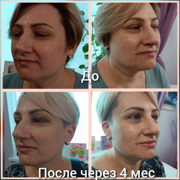 Ниткове армування