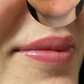 Катерина Поліщук, Днепр Фото - 19