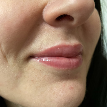 Катерина Поліщук, Днепр Фото - 17