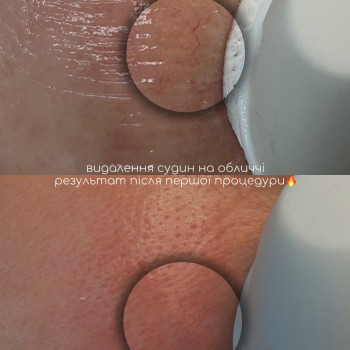 JV Lazer, Івано-Франківськ Фото - 13