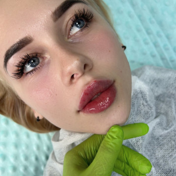 Первинна корекція молодих губ