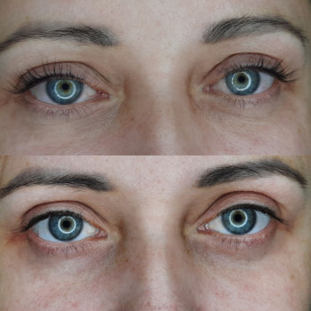 Ламінування вій