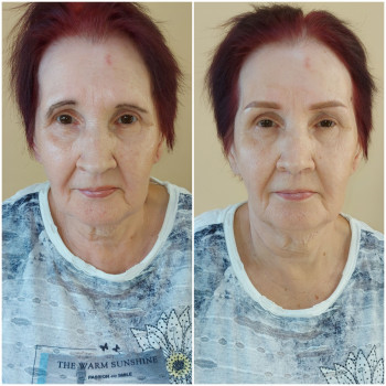 Фото ДО ( кієнтка сама собі так малювала) та ПІСЛЯ.
ПУДРОВЕ НАПИЛЕННЯ БРІВ