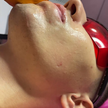 Лазерна епіляція
                    Майстер депіляції Олена Дніпро