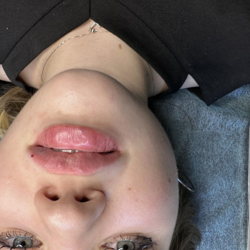 Анна Оліяр, Коломия Фото - 8