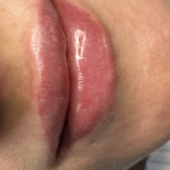 Анна Оліяр, Коломия Фото - 24