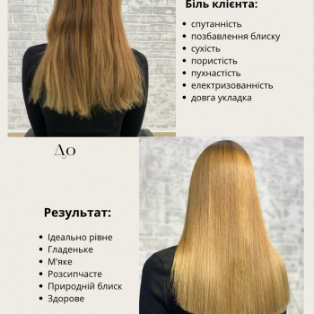 Органопластія+ботокс