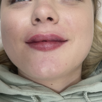 Валерія Мельник, Полтава Фото - 7