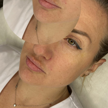 Валерія Мельник, Полтава Фото - 9