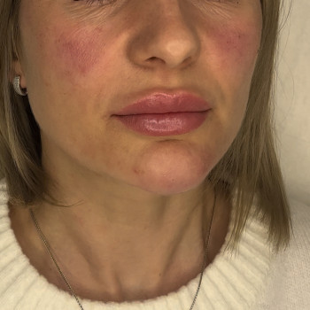 Валерія Мельник, Полтава Фото - 10