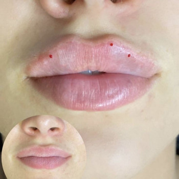 Фото з портфоліо косметолога Валерія Мельник (Полтава)