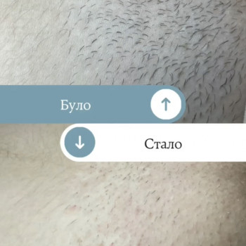 Єлизавета Epil, Київ Фото - 4