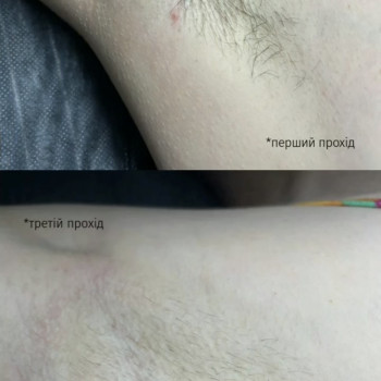 Єлизавета Epil, Київ Фото - 32