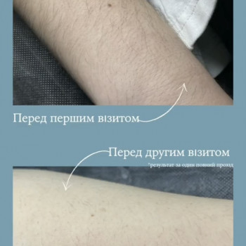 Єлизавета Epil, Київ Фото - 11