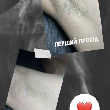 Єлизавета Epil, Київ Фото - 12