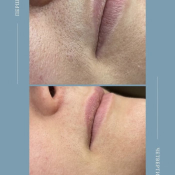 Єлизавета Epil, Київ Фото - 20