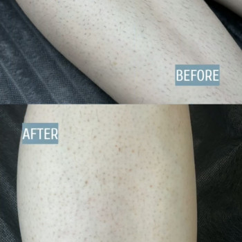 Єлизавета Epil, Київ Фото - 19