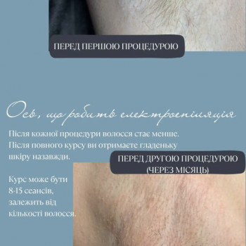 Єлизавета Epil, Київ Фото - 8