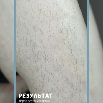 Єлизавета Epil, Київ Фото - 14