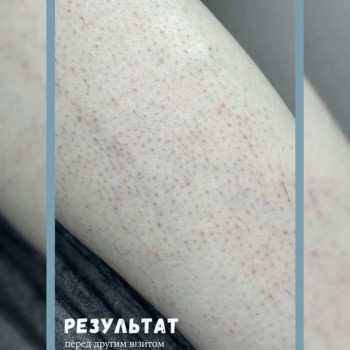 Єлизавета Epil, Київ Фото - 15