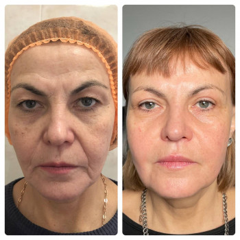 Все обличчя по спеціальному протоколу