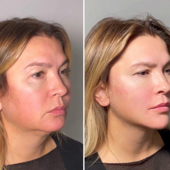 Cosmo Beauty, Київ Фото - 15