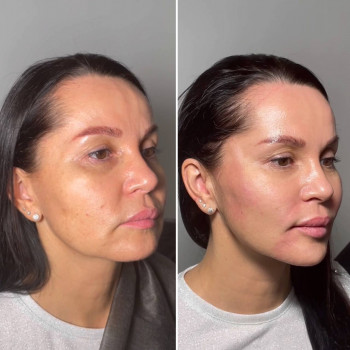 Cosmo Beauty, Київ Фото - 20