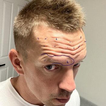 Для чоловіків