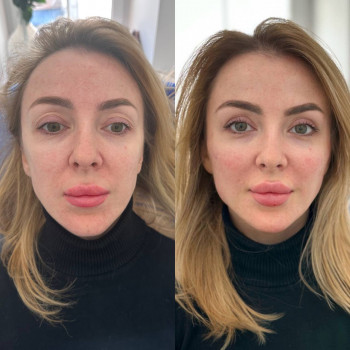 Комплексна робота