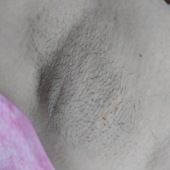 До, після гоління