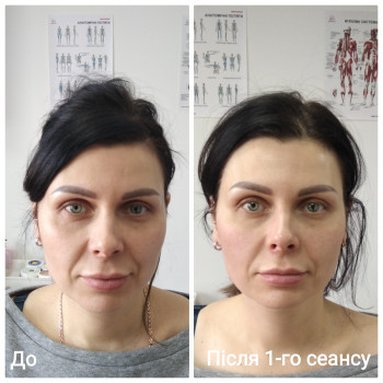 Масаж обличчя
                    Масажист Юлия Київ