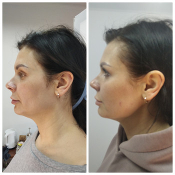 Масаж обличчя
                    Масажист Юлия Київ