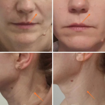 Масаж обличчя
                    Масажист Юлия Київ