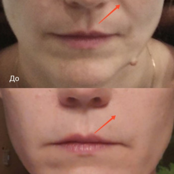 Масаж обличчя
                    Масажист Юлия Київ