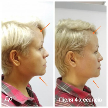 Масаж обличчя
                    Масажист Юлия Київ