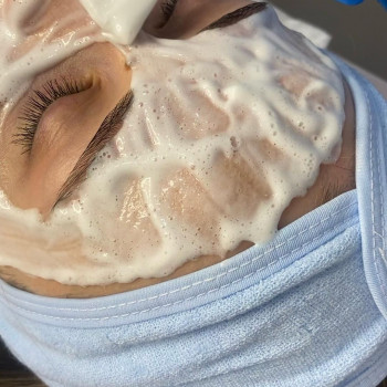 Карбоксітерапія
                    Дерматолог косметолог Анастасия Славута