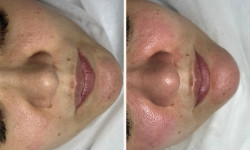 Професійний догляд Дерматолог косметолог Анастасия Славута