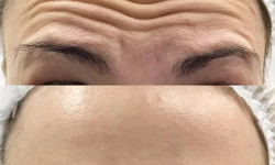 Full Face Косметолог Ирина Одеса