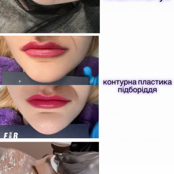 Німфа, Олександрія Фото - 8